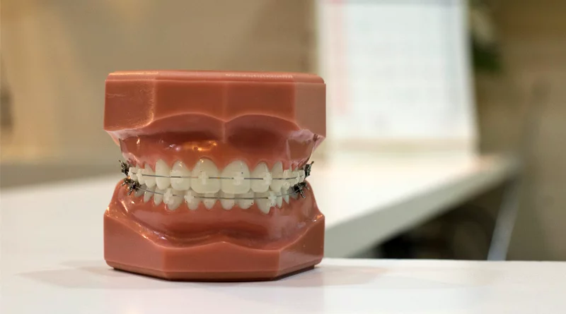 ویتامین D و سلامت لثه و دندان ها