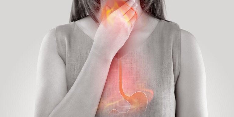 اسید معده بالا