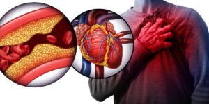 کلسترول چیست