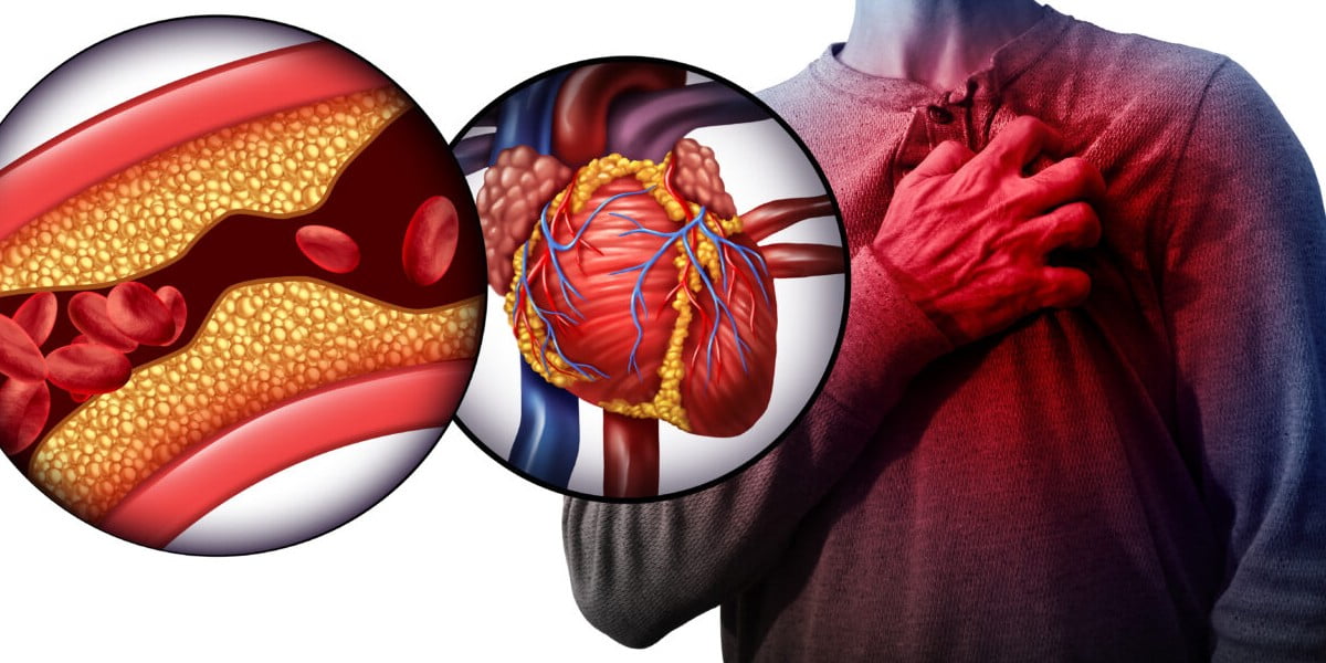 کلسترول چیست